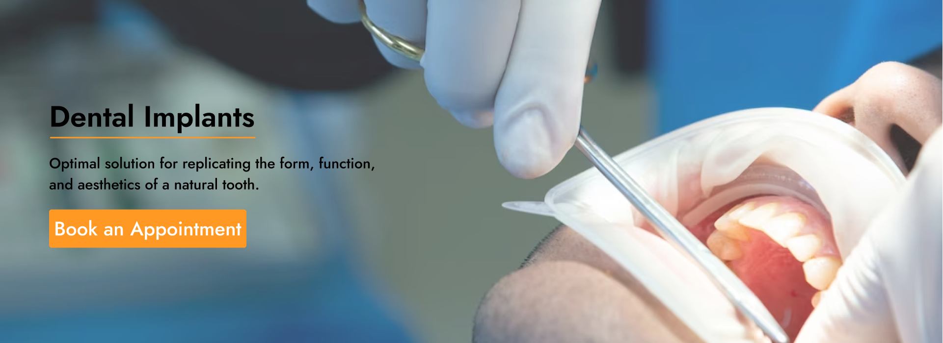 The Dentist Best Dental Clinic Electronic City Phase 1